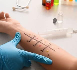 Our services includes - Allergy Testing